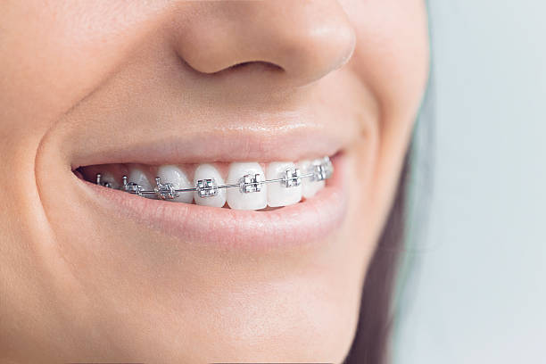 Best Dental Exams and Cleanings  in Kitsap Lake, WA